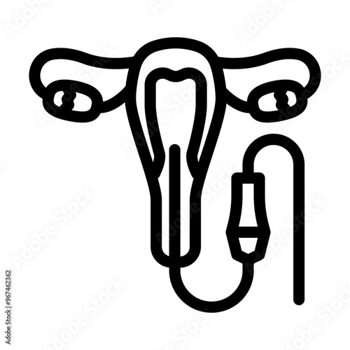 hysteroscopy surgery line icon vector. hysteroscopy surgery sign. isolated contour symbol black illustration