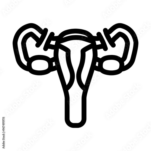 tubal ligation surgery line icon vector. tubal ligation surgery sign. isolated contour symbol black illustration photo