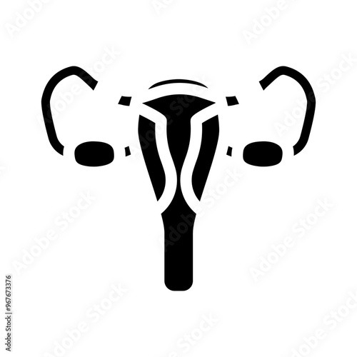 tubal ligation surgery glyph icon vector. tubal ligation surgery sign. isolated symbol illustration