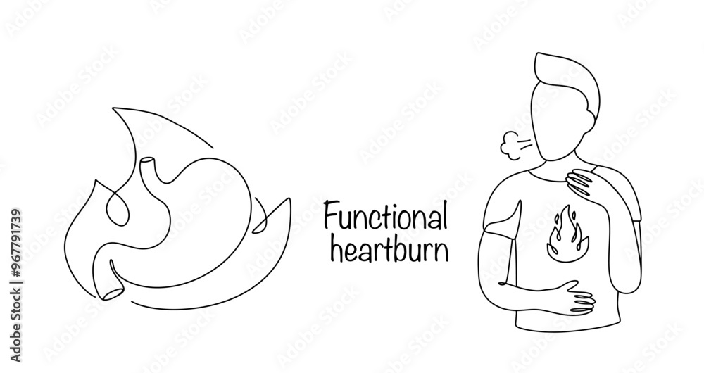 Functional heartburn Functional heartburn