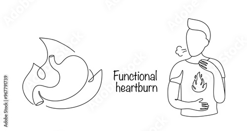 Functional heartburn