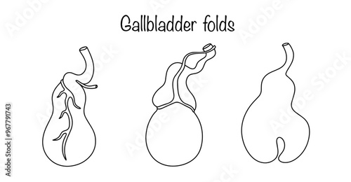 Gallbladder folds