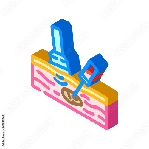biopsy surgery isometric icon vector. biopsy surgery sign. isolated symbol illustration