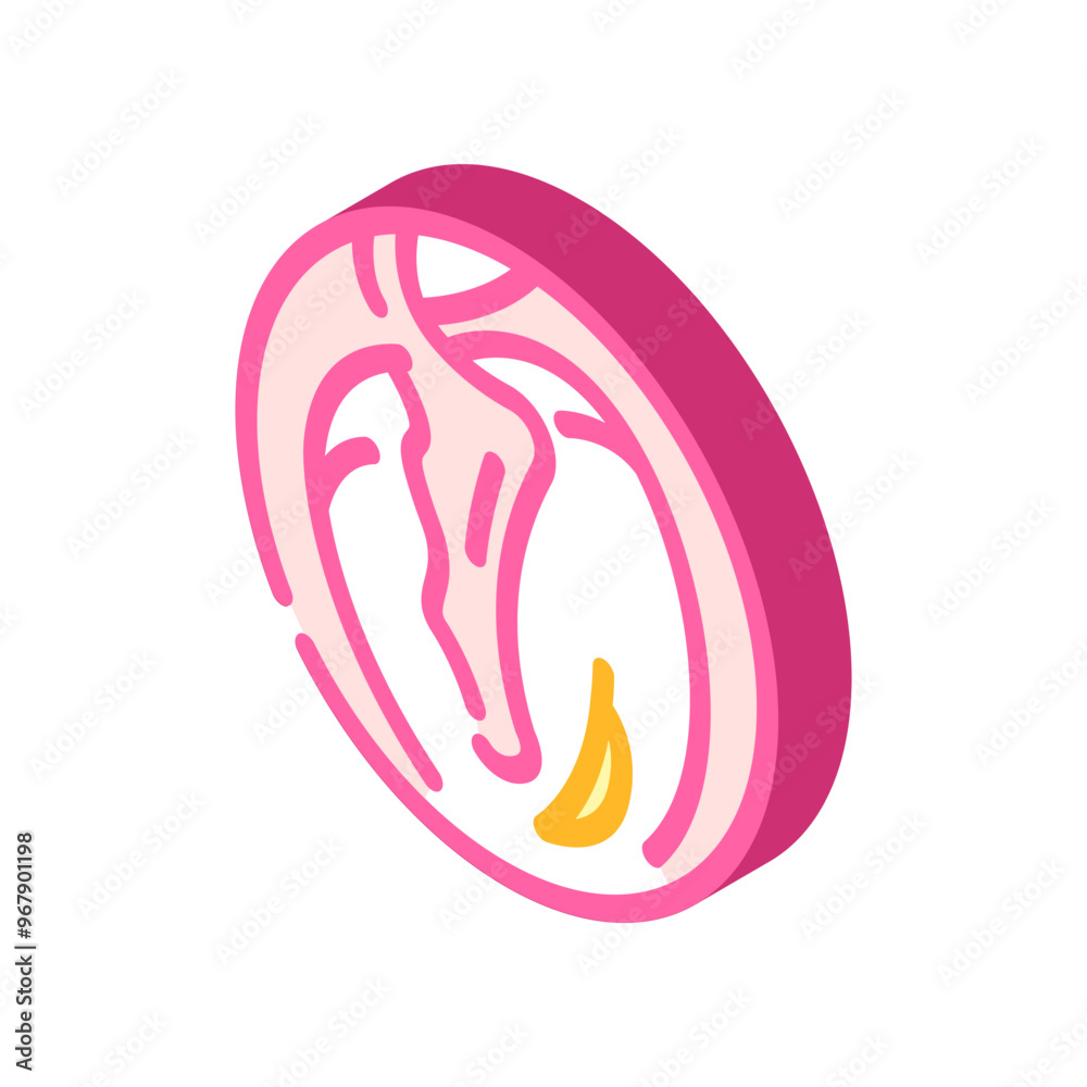 myringotomy surgery isometric icon vector. myringotomy surgery sign. isolated symbol illustration myringotomy surgery isometric icon vector. myringotomy surgery sign. isolated symbol illustration