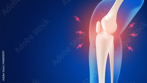 Vector illustration of knee joint and leg bones pain throbbing bones on blue background. 3D editable