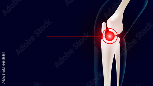 Knee joint and leg bones pain throbbing bones on blue dark background. 3D vector illustration editable