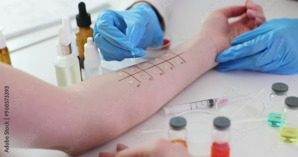 Skin allergy testing process in a dermatology clinic with description of allergen
