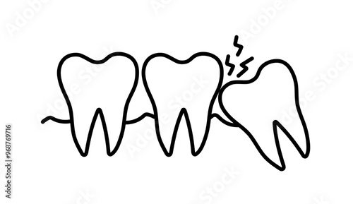 Crooked teeth. Impacted wisdom tooth. Toothache molar. Gum Recession. Damaged tooth. Vector illustration
