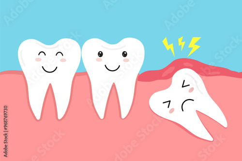 Impacted wisdom tooth. Crooked teeth. Toothache molar. inflamed and swollen gum. Dental care. Vector illustration