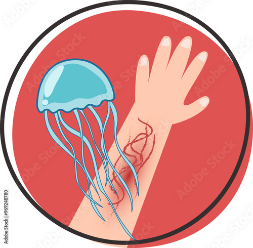 Jellyfish poisoning hurt injury concept