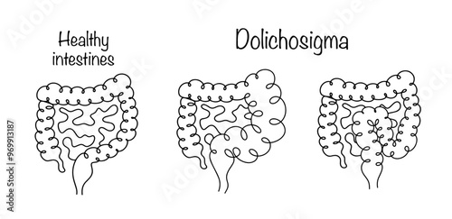 Dolichosigma
