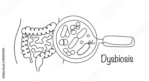 Dysbiosis