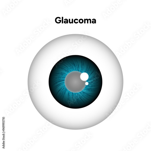 Eye structure defect eye Glaucoma