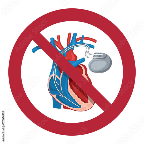 No access for people with active implanted cardiac devices. Interference to the operation of or damage to active implanted cardiac devices from equipment generating strong electromagnetic fields