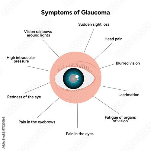 Symptoms of Glaucoma eye problem infographic and information 