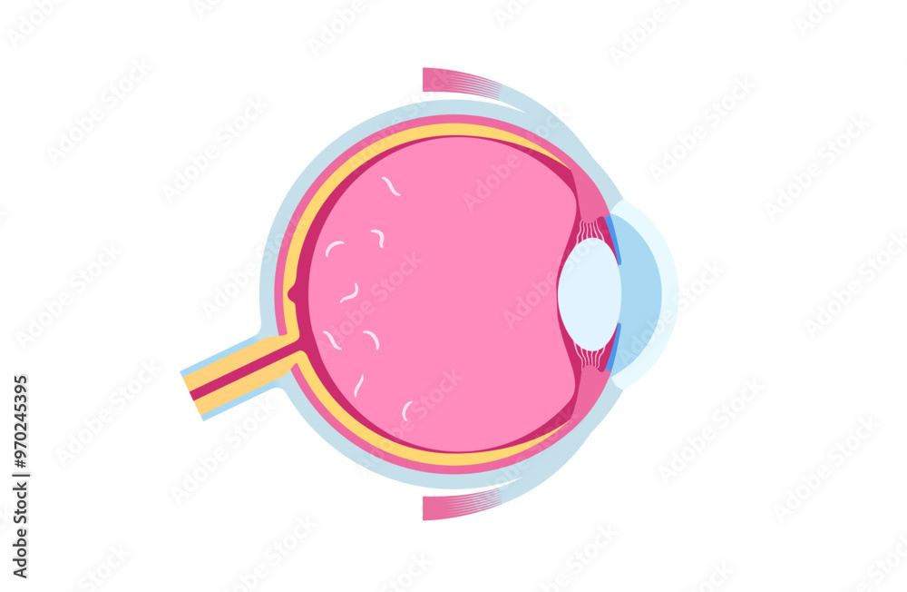 Myodesopsia eye floaters Myodesopsia eye floaters