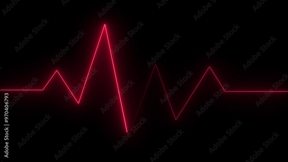 Green Bright heart rhythm background 4K heartbeat monitor EKG line monitor shows heartbeat, seamless loop electrocardiogram medical screen with a graph of heart rhythm, indicates life moving, indicate Green Bright heart rhythm background 4K heartbeat monitor EKG line monitor shows heartbeat, seamless loop electrocardiogram medical screen with a graph of heart rhythm, indicates life moving, indicate