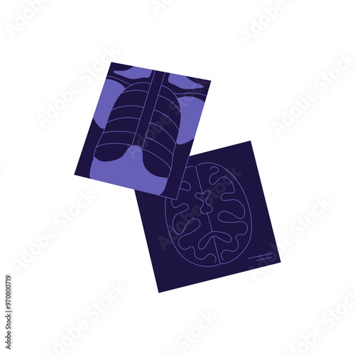 Xray and MRI results. X ray images of bones, CT of brain. Computed tomography scans, radiograms. Radiology icon. Medical checkup, healthcare. Flat isolated vector illustration on white background