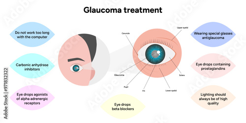 Glaucoma treatment medical information and anatomy ophthalmologist