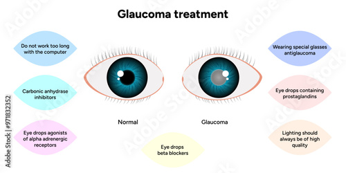 Glaucoma treatment medical information ophthalmologist photo