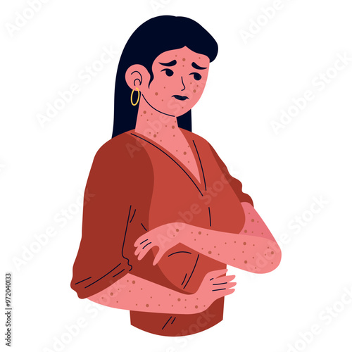 woman with monkey pox virus