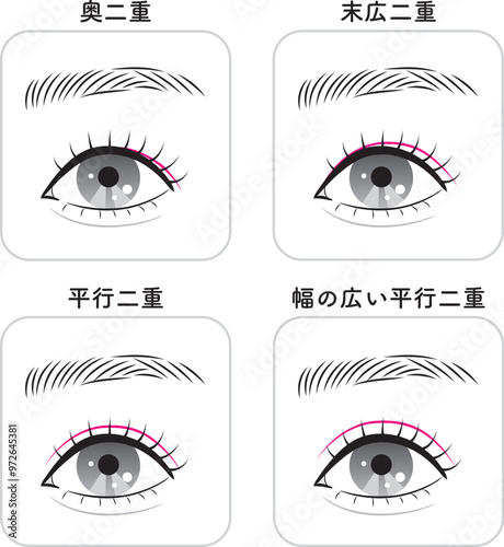 二重の種類セット