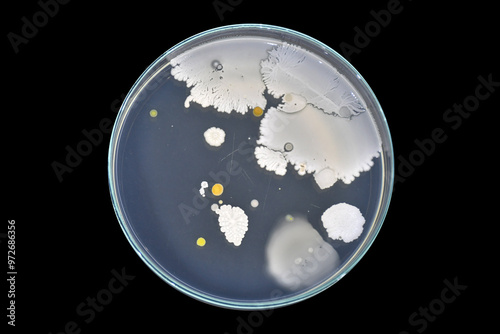 Bacterial load in food handlers. Bacteria in human hair. Bacteria in human beard. Personal hygiene test. Swab test in hair. Swab test in beard. Bacteria in hair. Bacteria in beard.  photo