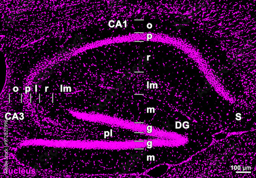 マウス海馬における細胞分布を示す蛍光画像。全ての細胞が染まる核染色を行い、マゼンタで示している。注：錐体細胞層（p）および顆粒細胞層（g）は特に細胞が密集する層であり、錐体細胞層（p）は虚血に特に弱い。 photo
