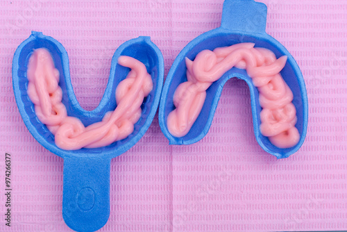 Top view of two blue fluoride gel foam trays filled with pink fluoride gel. These trays are used during fluoride treatment to strengthen teeth and prevent cavities in a dental settin