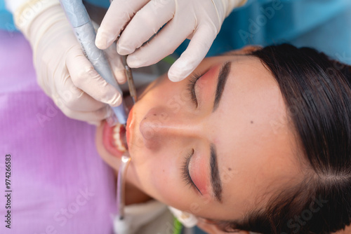 A female patient undergoing oral prophylaxis or dental cleaning procedure. A dental scaler is being used to remove plaque or tartar from the teeth, while a saliva ejector keeps the area dry.