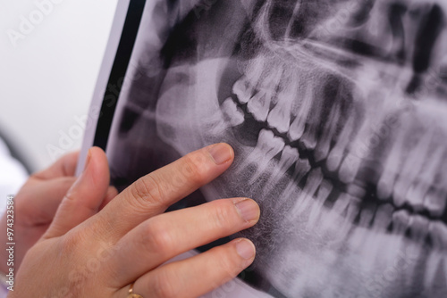 A close-up of a dental X-ray with a hand pointing to missing molar. The X-ray reveals details of the teeth and jaw, possibly highlighting an issue like impacted teeth or cavities