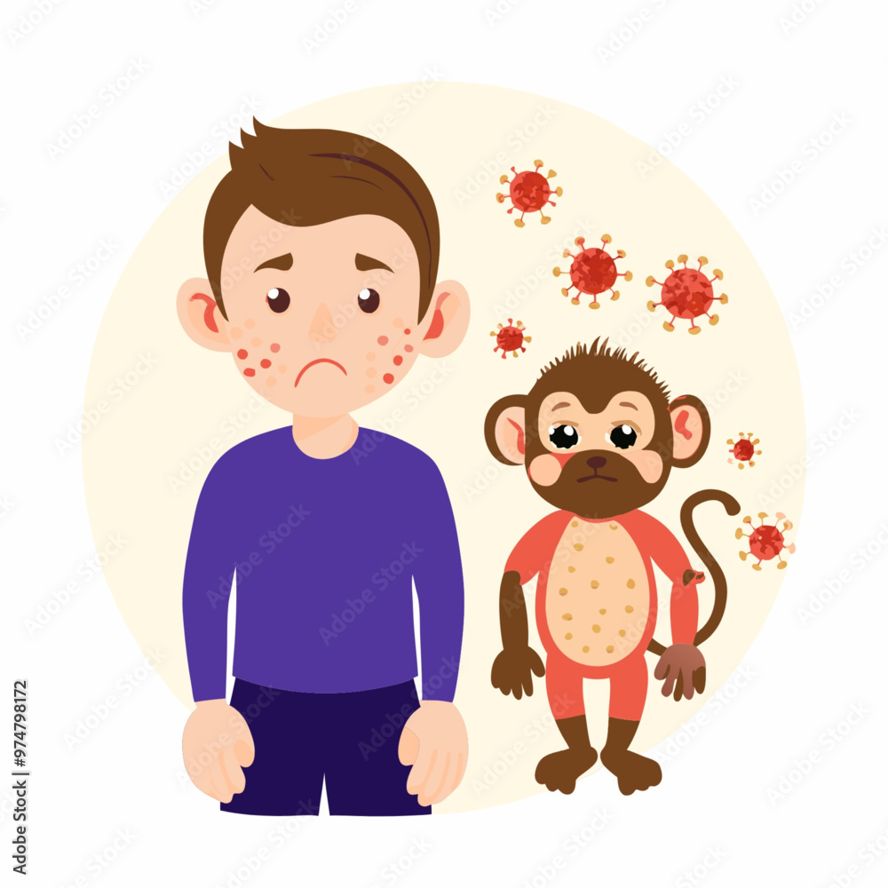 Illustration of Monkeypox Virus with Human Hands and Red Pathogens Illustration of Monkeypox Virus with Human Hands and Red Pathogens