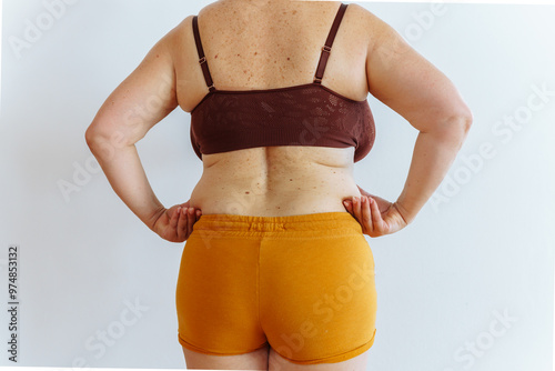 Canvas-taulu unrecognizable woman showing fat belly with saggy skin