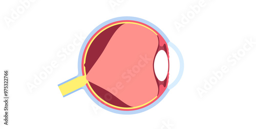 Posterior vitreous detachment