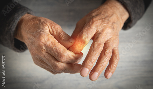 Caucasian elderly woman suffering from finger pain.