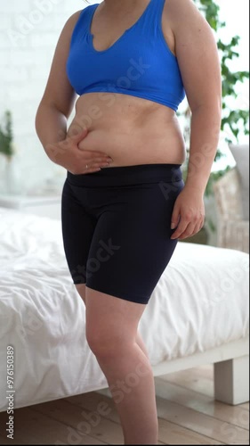 Abdominal massage, tummy tuck and flabby skin on a fat belly, woman doing self-massage, plastic surgery concept photo