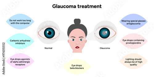 Glaucoma treatment medical information ophthalmologist photo