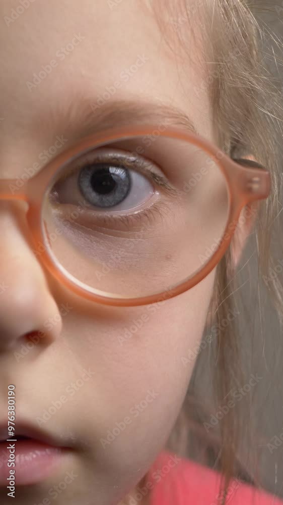 Funny little girl in glasses with eye problem. Vision issues, child treatment. Toothless adds charm. Kids playful expression highlights innocence and resilience. Glasses help manage vision challenges