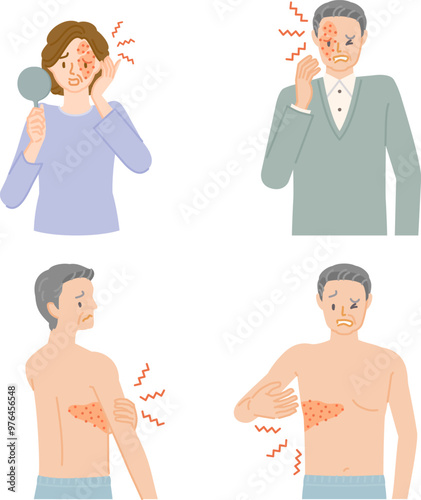 帯状疱疹：痛みやかゆみ、腫れがある中年の男女イラストセット
