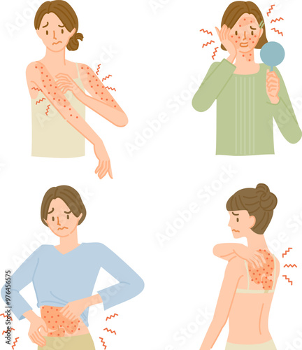 皮膚の病気：肌がかゆくてイライラする女性イラストセット