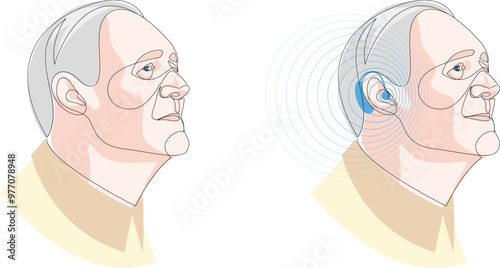 Senior man wearing hearing aid and hears well. Otolaryngology treatment concept. One line drawing of healthcare device, medicine technology. Vector illustration.