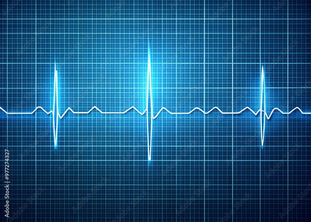 Naklejka premium A realistic illustration of an ECG waveform displaying a left bundle branch block pattern with a subtle grid background and clear annotations