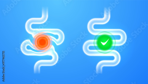 Comparison of healthy and inflamed gut. Intestinal health problems and solutions - element for infographic medical illustrations, health education and anatomy studies. Concept gastroenterology
