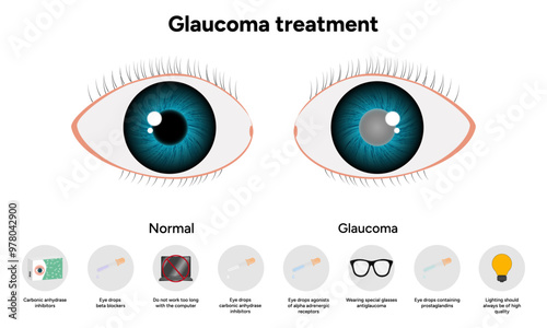 Glaucoma treatment medical information ophthalmologist