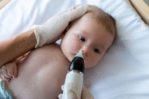 Unrecognizable doctor in medical gloves checking nose of baby girl or boy photo