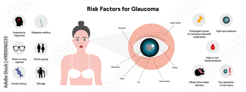 Risk factors for glaucoma disease Optometry photo