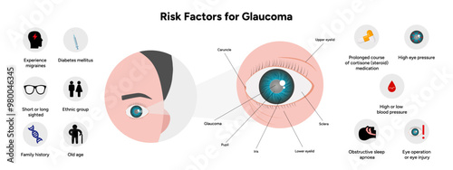 Risk factors for glaucoma disease Optometry