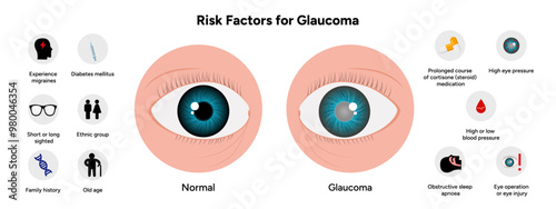 Risk factors for glaucoma disease Optometry
