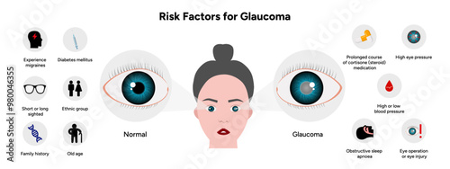 Risk factors for glaucoma disease Optometry