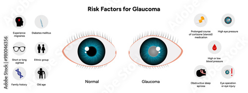 Risk factors for glaucoma disease Optometry